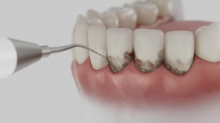 Reliable Emergency Dentist contractor in Seneca, IL by Smile Center Dentistry